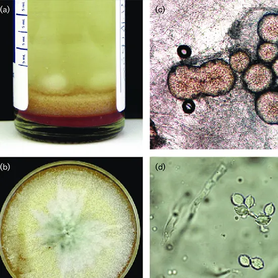 Fungus Culture Ascitic Fluid
